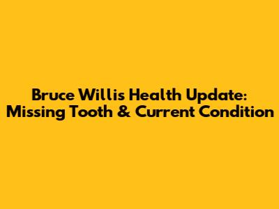 Bruce Willis Health Update: Missing Tooth & Current Condition
